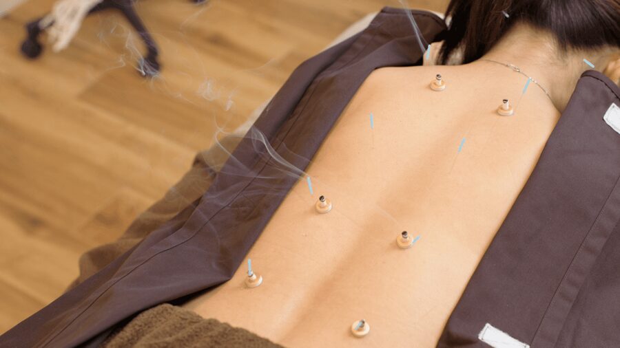 Hiroshima: Acupuncture and Japanese unique massage treatment - The experience for couples and companions